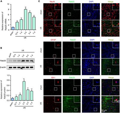 Ras-related protein Rab-20 inhibition alleviates cerebral ischemia/reperfusion injury by inhibiting mitochondrial fission and dysfunction